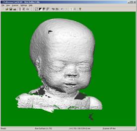 The fetal doll: raw data comprising approximately 141,000 facets